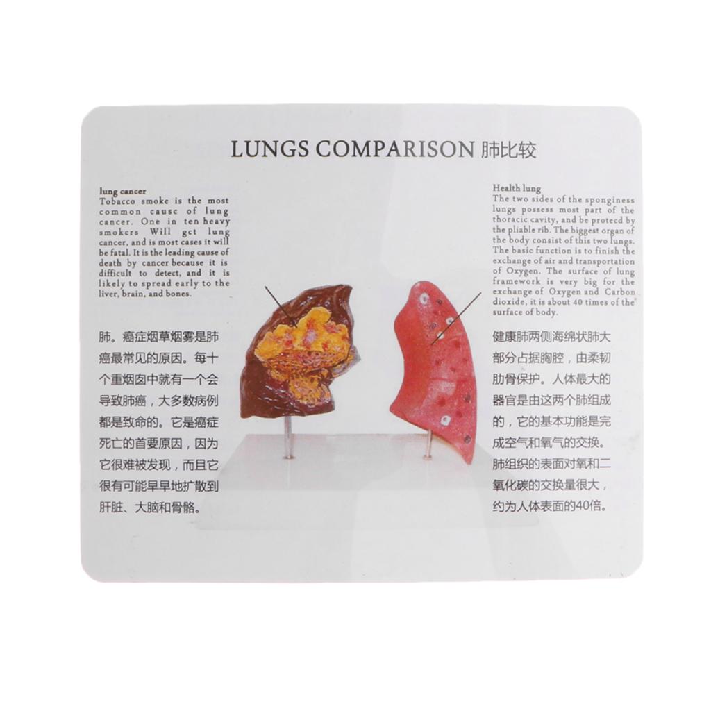 Human Lung Normal Comparison M - Medical Lab Supplies review and price